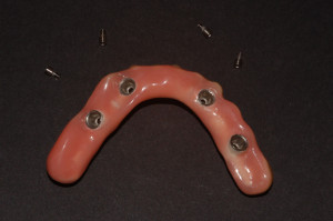 Controllo delle aree a contatto con la mucosa